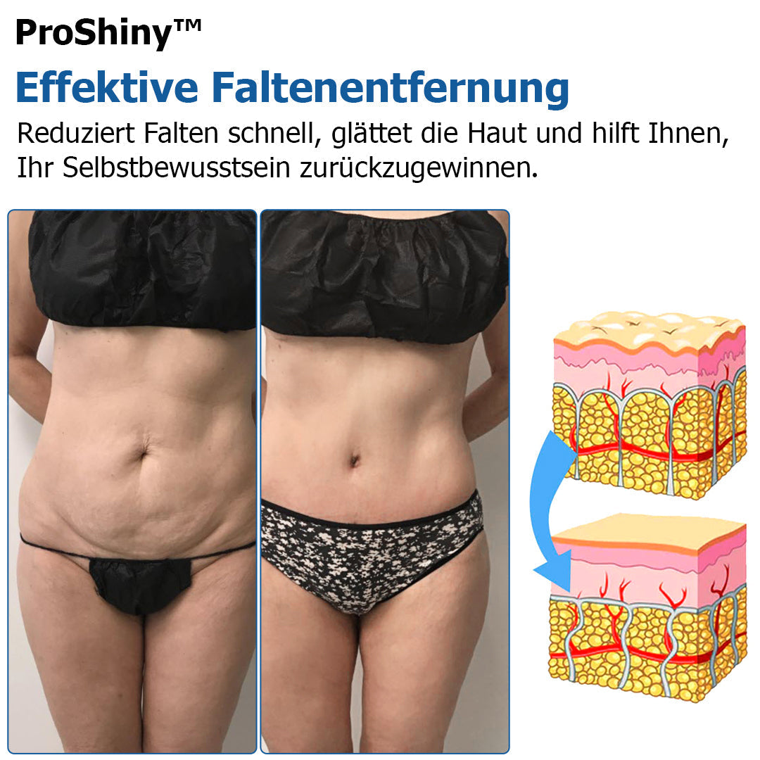 Proshiny™ Thermische Zyklusformende Leggings - Hergestellt in Deutschland